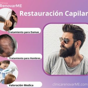 tratamientos con botox,tratamientos con acido hialuronico, depiulacion laser, tratamiento para alopecia, clinicarenovarme 6