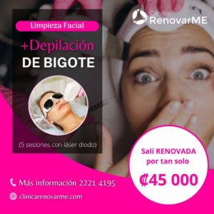 limpieza facial, depilacion facil con laser, tratamientos de belleza, depilacion laser, limpieza facial profunda