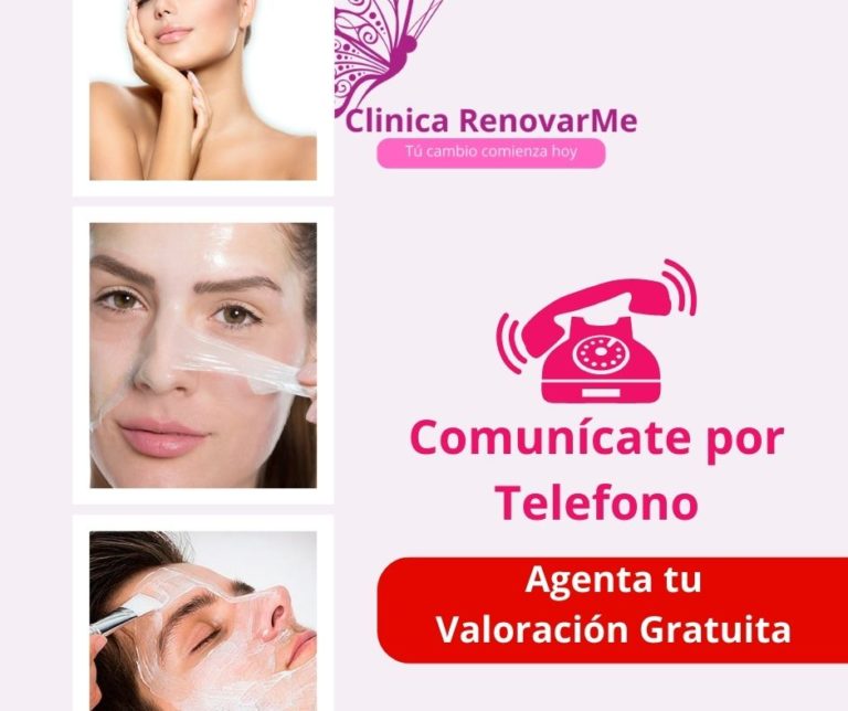 tratamiento peeling quimico, limpieza facial, limpieza facial profunda, limpieza de cara, limpieza de rostro, clinicarenovarme