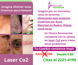 tratamiento laser co2, tratamiento facial co2 fraccionado, tratamientos para melasma, cicatrices de acne, rejuvenecimiento facial, laser co2 , clinica renovarme, costa rica 11