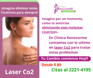 tratamiento laser co2, tratamiento facial co2 fraccionado, tratamientos para melasma, cicatrices de acne, rejuvenecimiento facial, laser co2 , clinica renovarme, costa rica 2