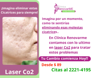 tratamiento laser co2, tratamiento facial co2 fraccionado, tratamientos para melasma, cicatrices de acne, rejuvenecimiento facial, laser co2 , clinica renovarme, costa rica 3