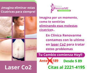 tratamiento laser co2, tratamiento facial co2 fraccionado, tratamientos para melasma, cicatrices de acne, rejuvenecimiento facial, laser co2 , clinica renovarme, costa rica