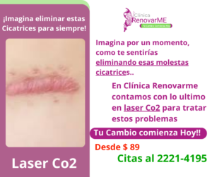 tratamiento laser co2, tratamiento facial co2 fraccionado, tratamientos para melasma, cicatrices de acne, rejuvenecimiento facial, laser co2 , clinica renovarme, costa rica 4