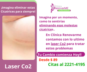 tratamiento laser co2, tratamiento facial co2 fraccionado, tratamientos para melasma, cicatrices de acne, rejuvenecimiento facial, laser co2 , clinica renovarme, costa rica 5