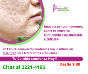 tratamiento laser co2, tratamiento facial co2 fraccionado, tratamientos para melasma, cicatrices de acne, rejuvenecimiento facial, laser co2 , clinica renovarme, costa rica 6