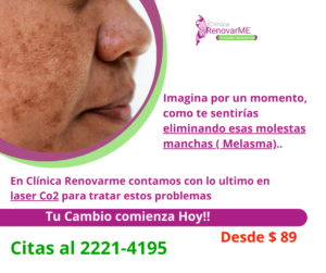 tratamiento laser co2, tratamiento facial co2 fraccionado, tratamientos para melasma, cicatrices de acne, rejuvenecimiento facial, laser co2 , clinica renovarme, costa rica 7