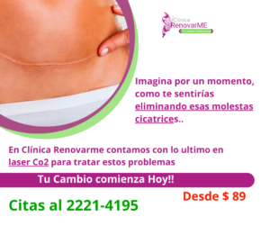 tratamiento laser co2, tratamiento facial co2 fraccionado, tratamientos para melasma, cicatrices de acne, rejuvenecimiento facial, laser co2 , clinica renovarme, costa rica 8