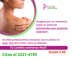 tratamiento laser co2, tratamiento facial co2 fraccionado, tratamientos para melasma, cicatrices de acne, rejuvenecimiento facial, laser co2 , clinica renovarme, costa rica 9